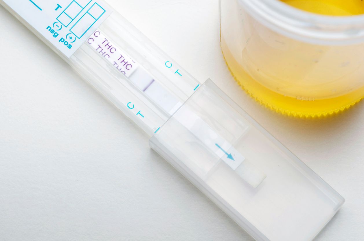 What you should know about cannabis drug testing