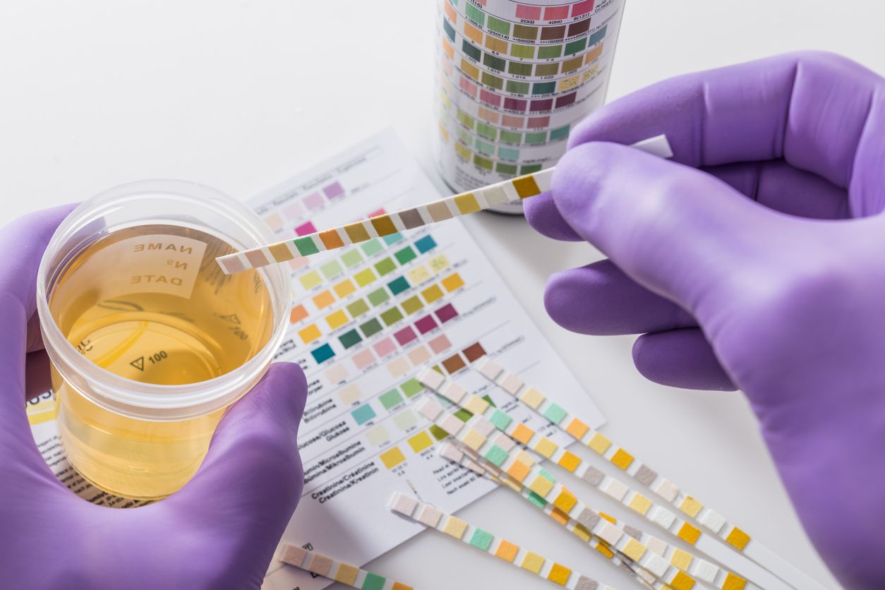 How does CBD Oil Affect A Drug Test 